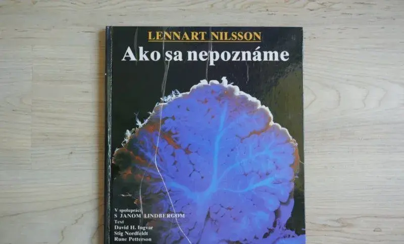 Lennart Nilsson – Ako sa nepoznáme